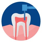 Icon-Root-Canal